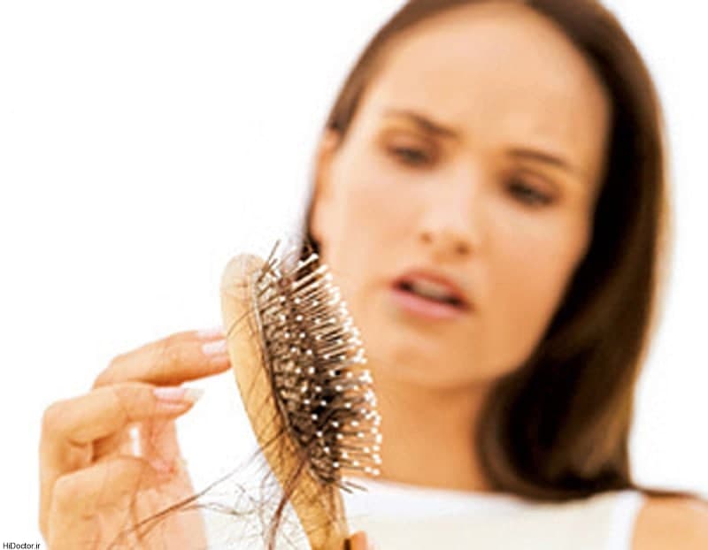 درمان ریزش مو |علت ریزش مو از ریشه چیست