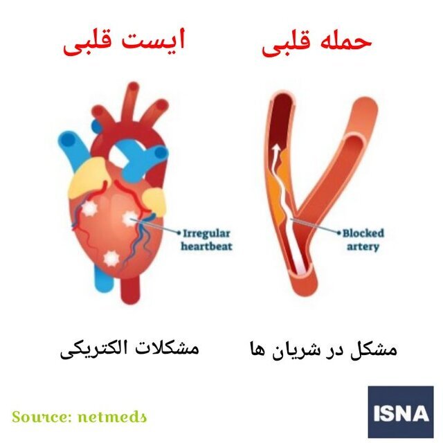 چرا ایست قلبی می‌کنیم؟