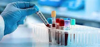 Hemoglobin test and normal amount of hb in blood test