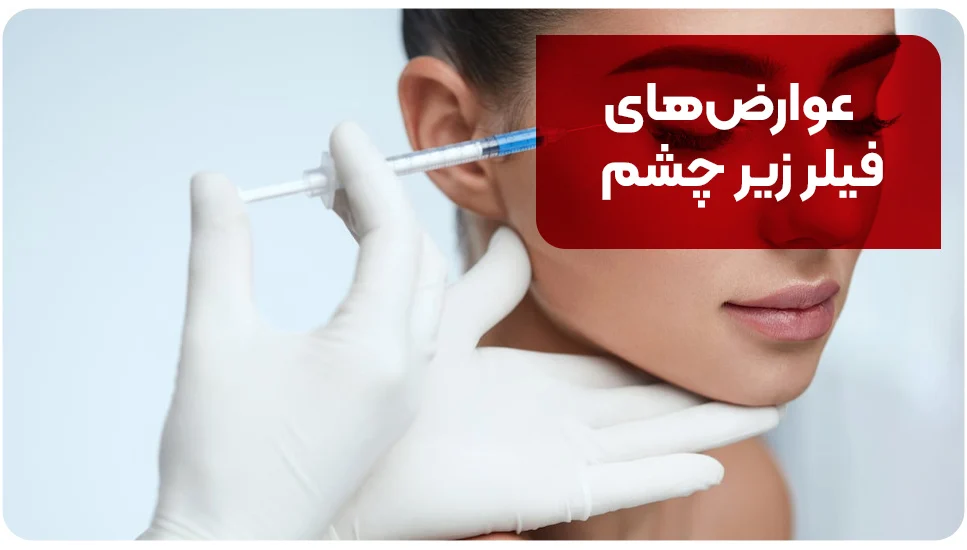 عوارض&zwnj;های فیلر زیر چشم