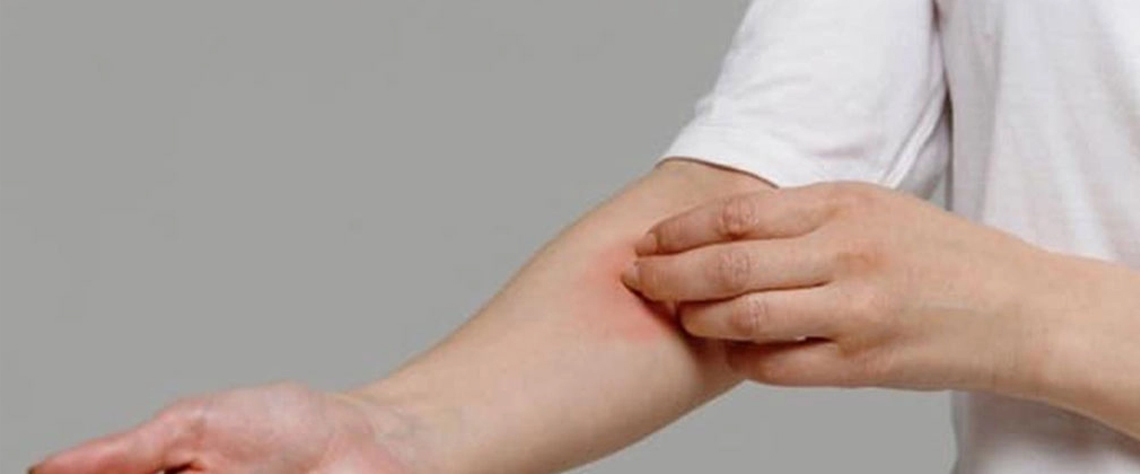 آبرسان |اسپری شناخت علائم اگزما و زمان استفاده از محصولات