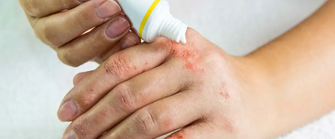 آبرسان |اسپری دسترسی آسان و خرید آنلاین