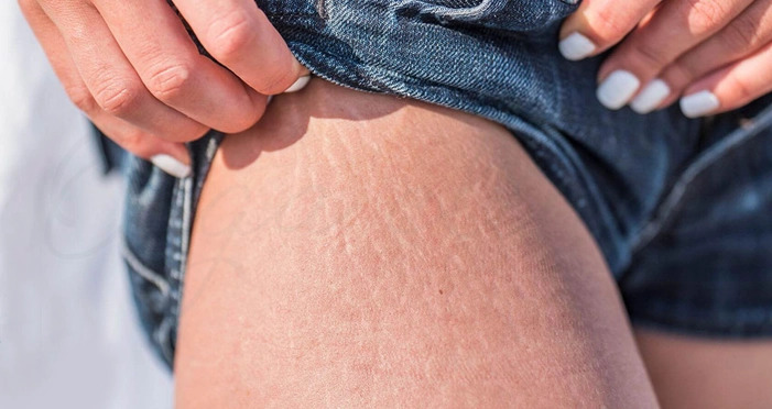 ایمنی |بارداری