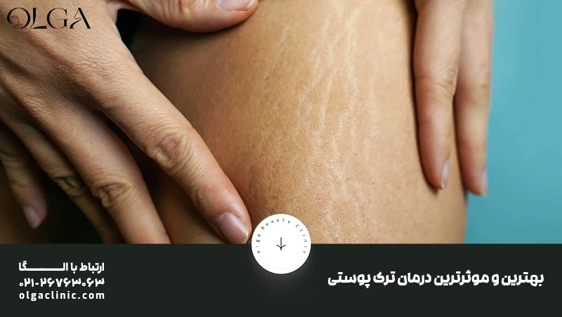 ایمنی |بارداری